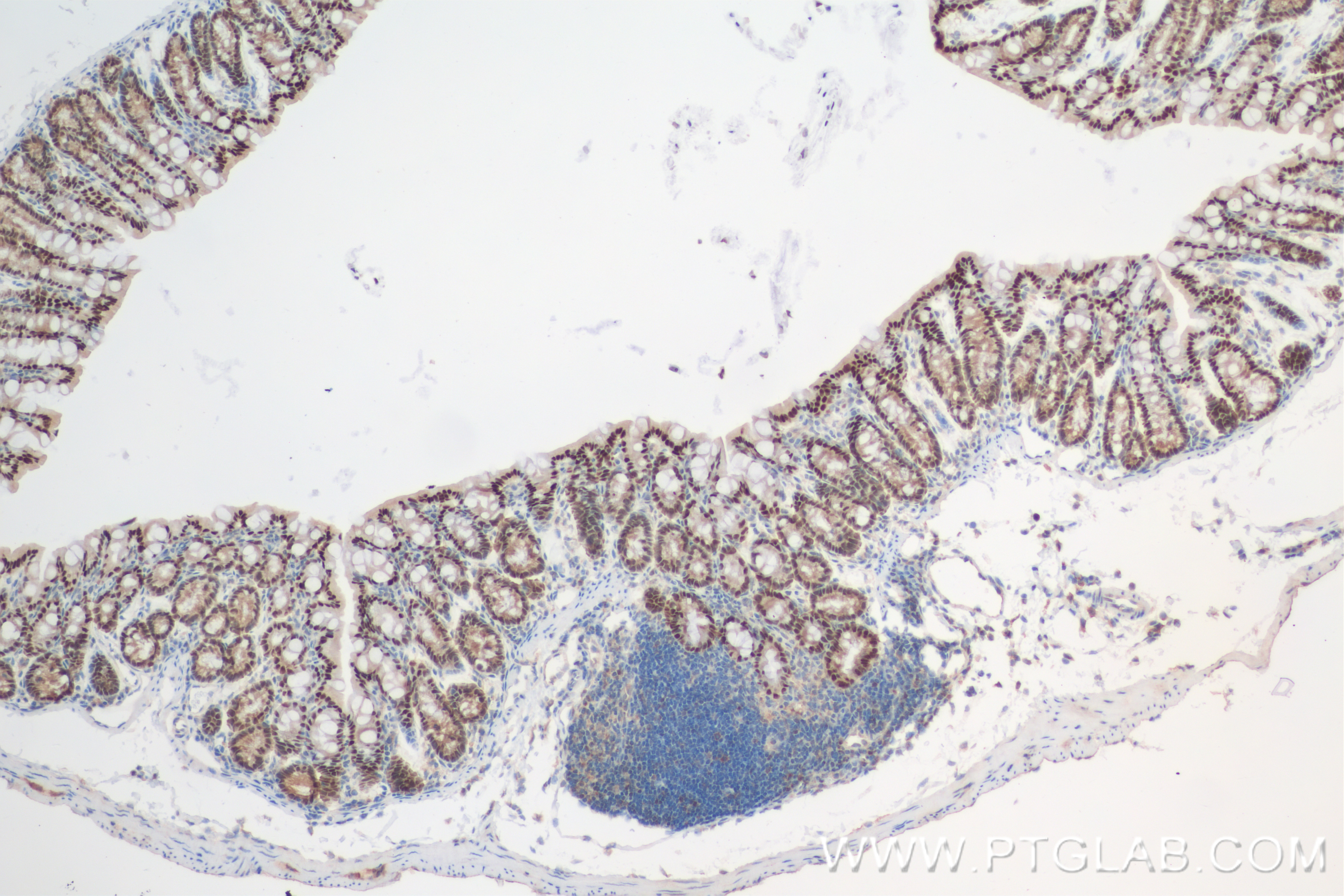 Immunohistochemistry (IHC) staining of mouse colon tissue using CDX2 Recombinant antibody (82659-1-RR)