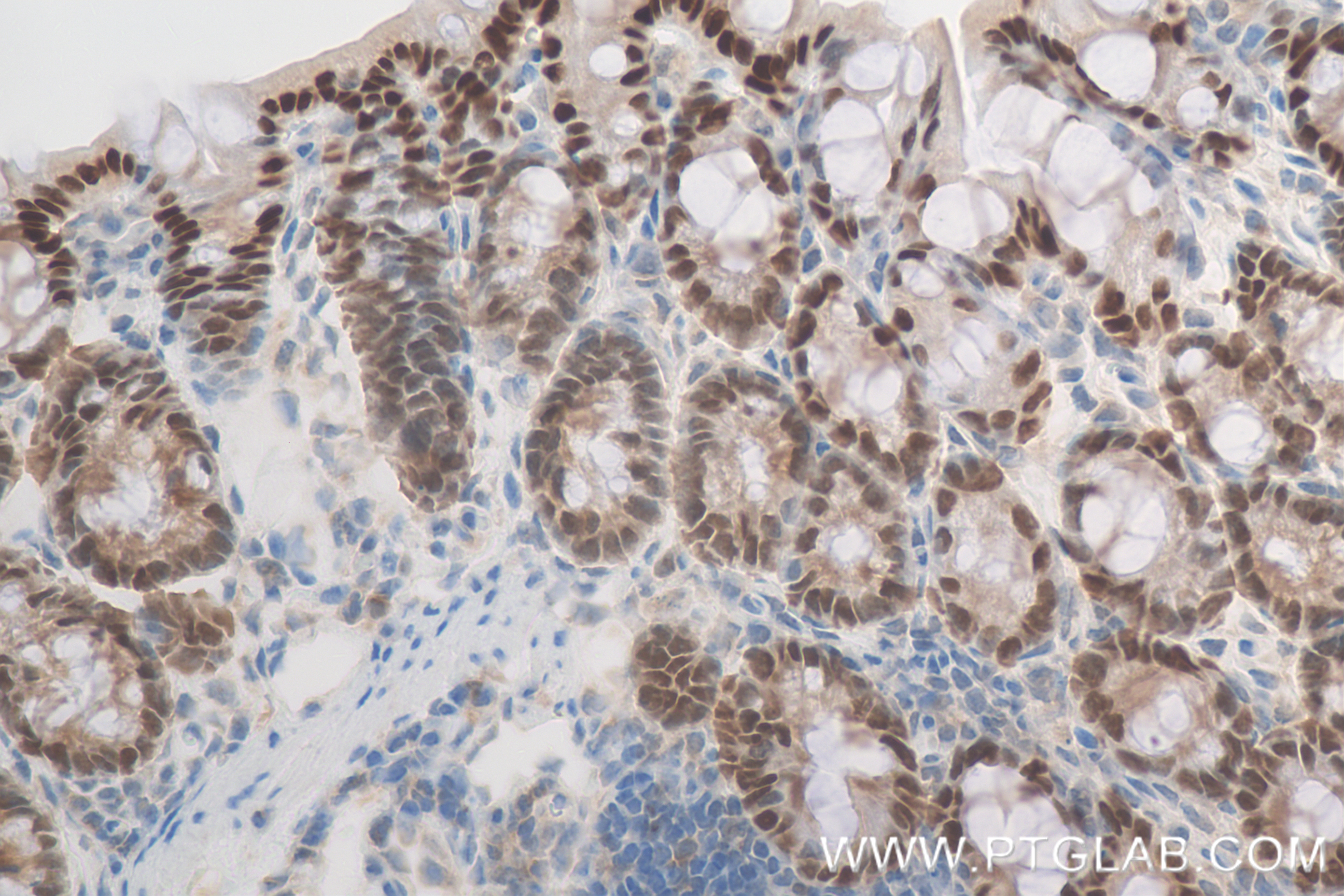 Immunohistochemistry (IHC) staining of mouse colon tissue using CDX2 Recombinant antibody (82659-1-RR)