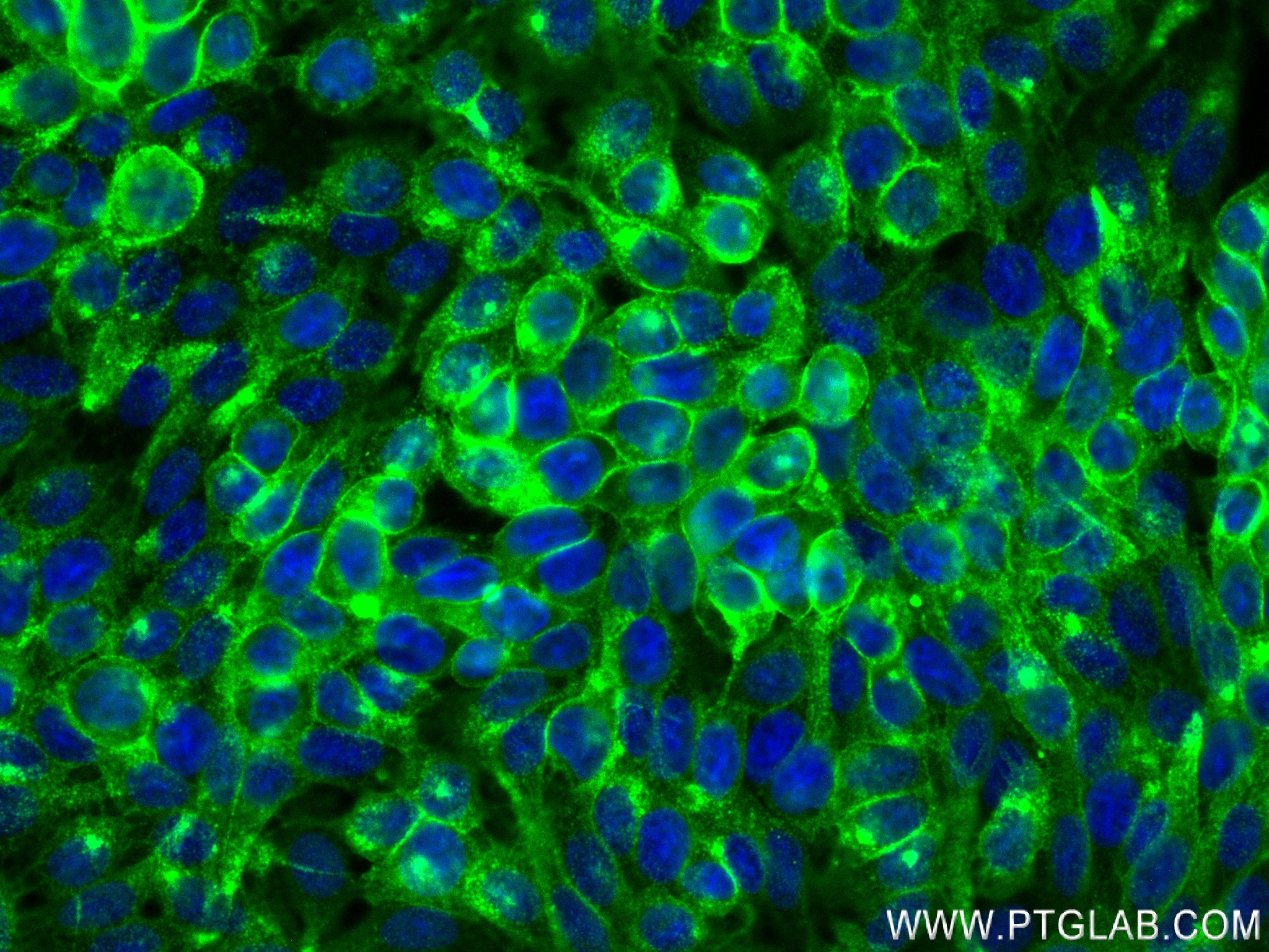 Immunofluorescence (IF) / fluorescent staining of HT-29 cells using CEA Recombinant antibody (83653-5-RR)