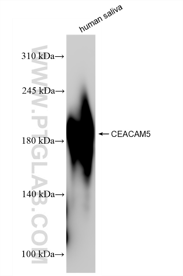 CEA/CD66e