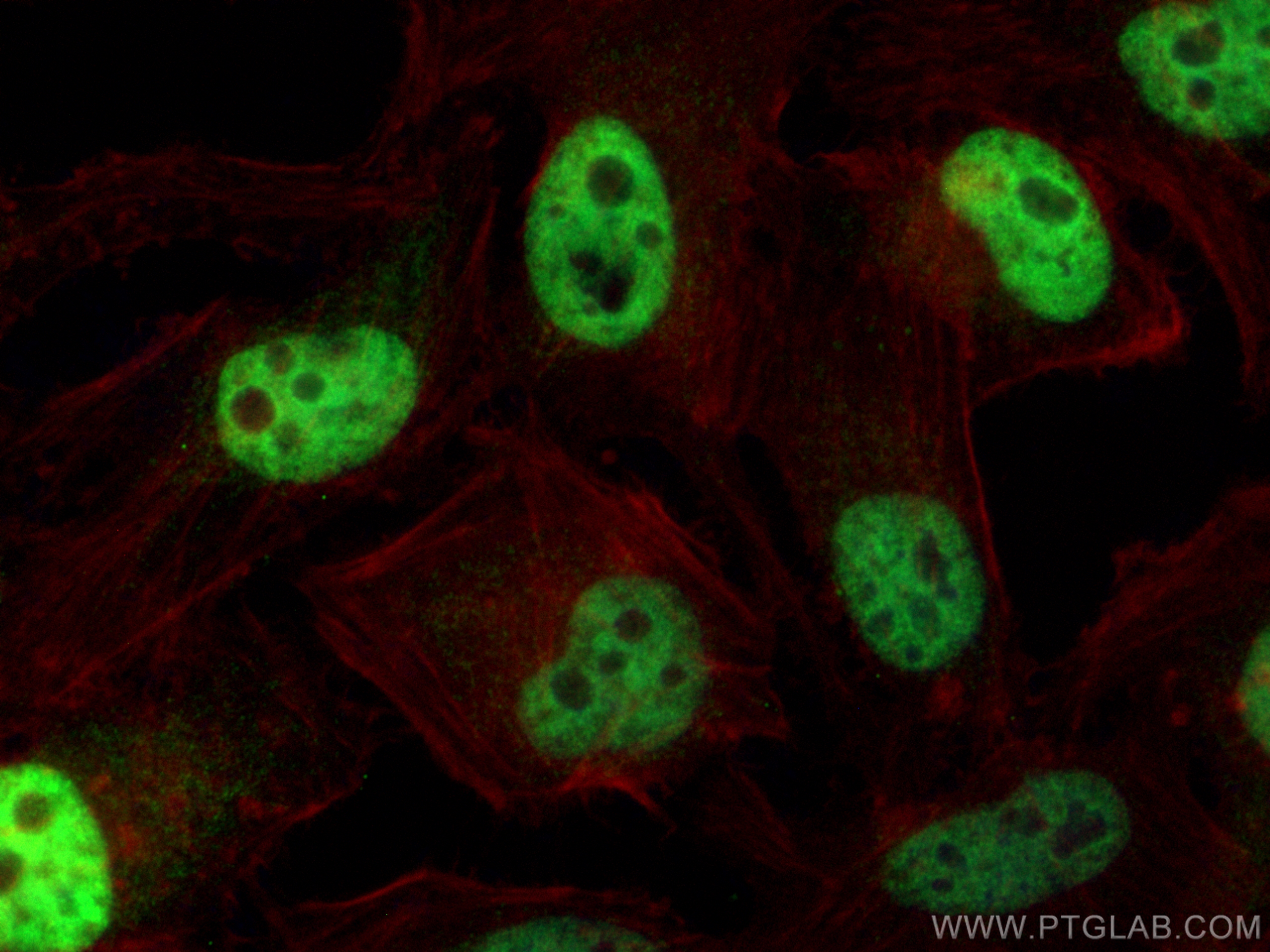 Immunofluorescence (IF) / fluorescent staining of HeLa cells using CEBPB Polyclonal antibody (23431-1-AP)
