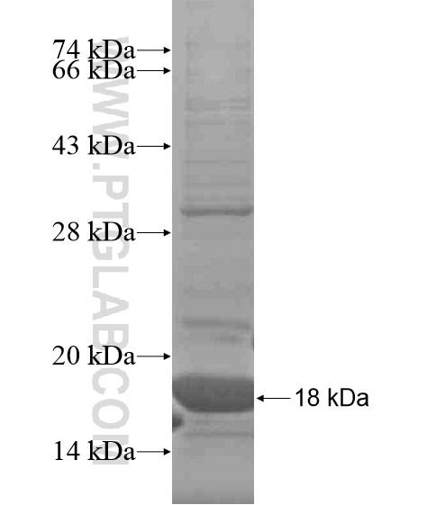 CEBPD fusion protein Ag20953 SDS-PAGE