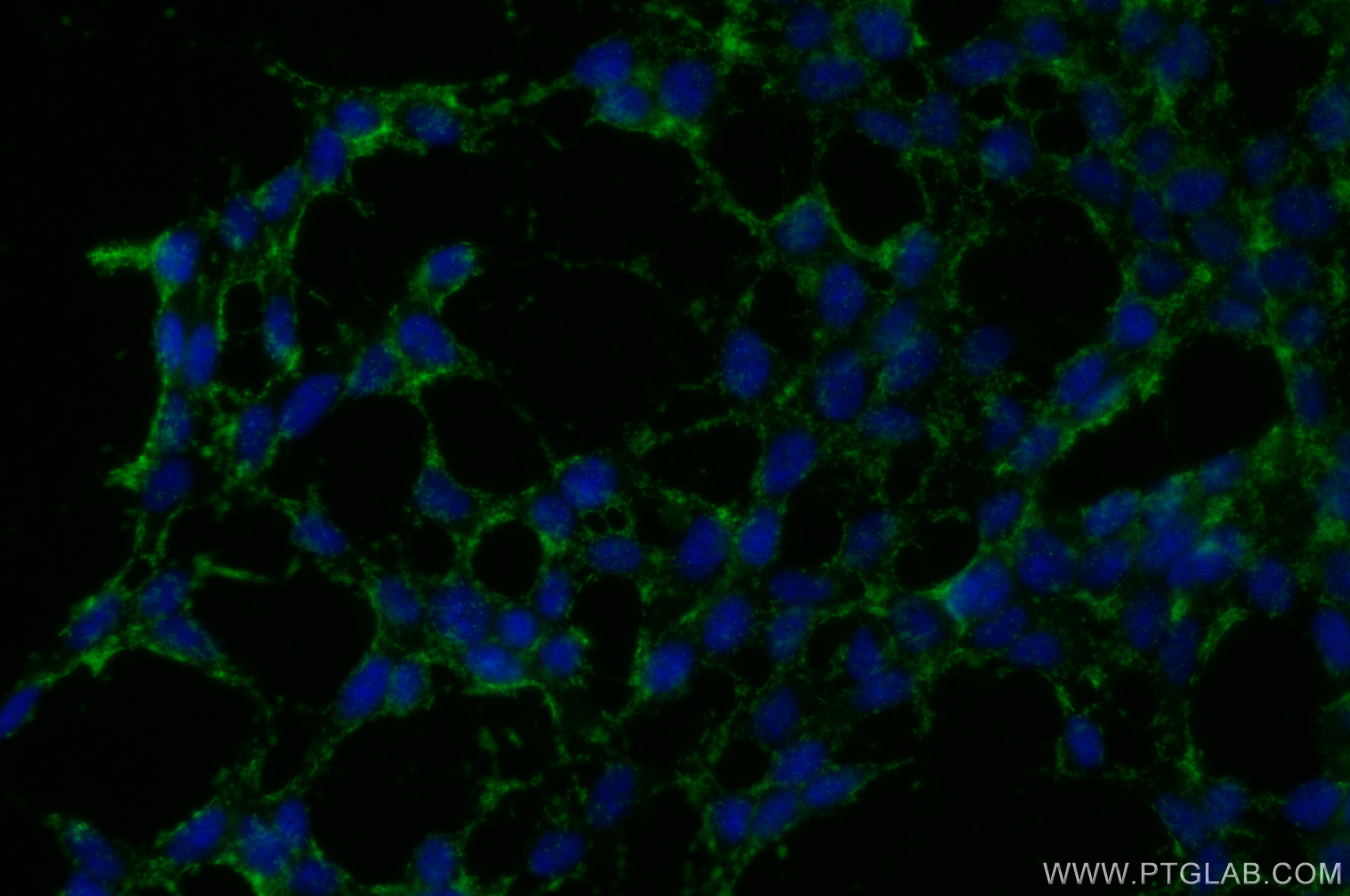 Immunofluorescence (IF) / fluorescent staining of SH-SY5Y cells using CELSR2 Polyclonal antibody (19940-1-AP)