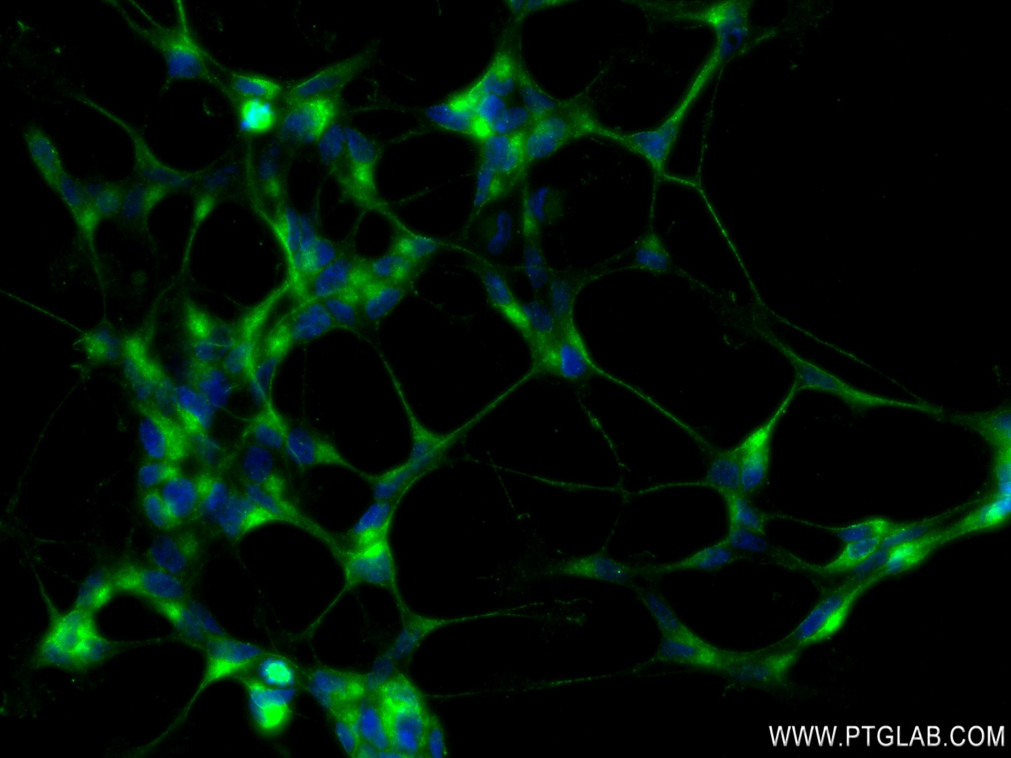 Immunofluorescence (IF) / fluorescent staining of SH-SY5Y cells using CELSR2 Recombinant antibody (83115-1-RR)