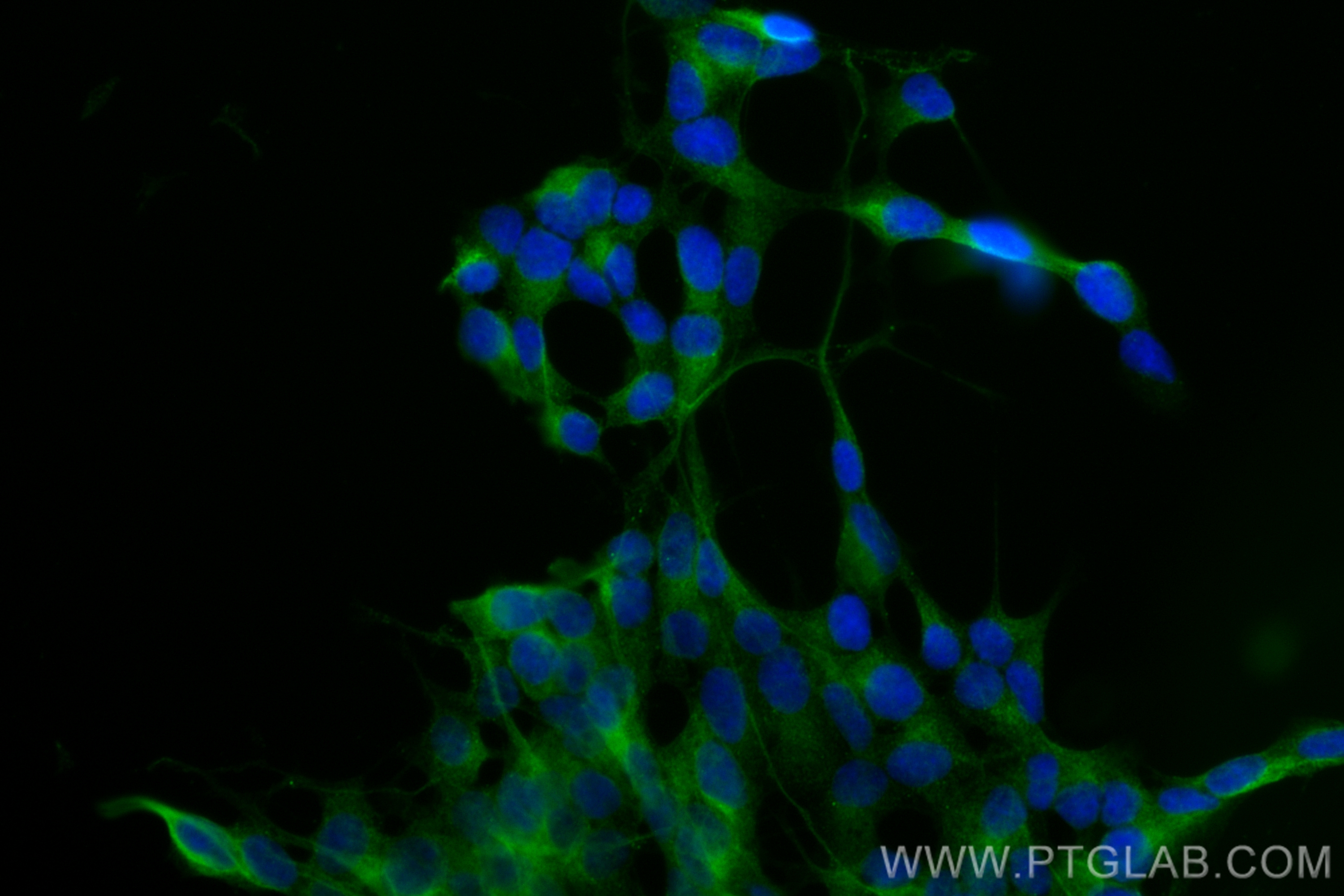 Immunofluorescence (IF) / fluorescent staining of SH-SY5Y cells using CoraLite® Plus 488-conjugated CELSR2 Recombinant a (CL488-83115)