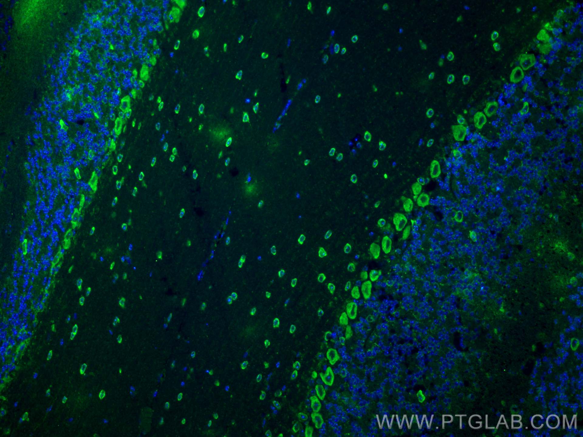 Immunofluorescence (IF) / fluorescent staining of mouse cerebellum tissue using CELSR3 Polyclonal antibody (28835-1-AP)