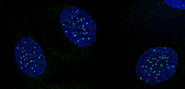 CENP-A phospho Ser18 antibody (pAb) tested by immunofluorescence. Detection of CENP-A phospho Ser18 by immunofluorescence. HeLa cells were stained with CENP-A phospho Ser18 antibody at a 1:100 dilution. Green: CENP-A phospho Ser18 antibody (pAb) Blue: DAPI