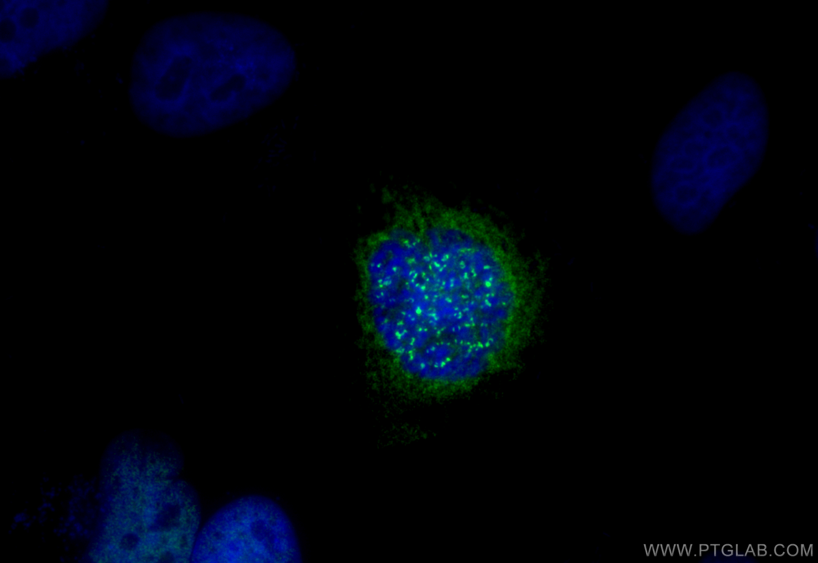 Immunofluorescence (IF) / fluorescent staining of HeLa cells using CENPF Polyclonal antibody (28568-1-AP)