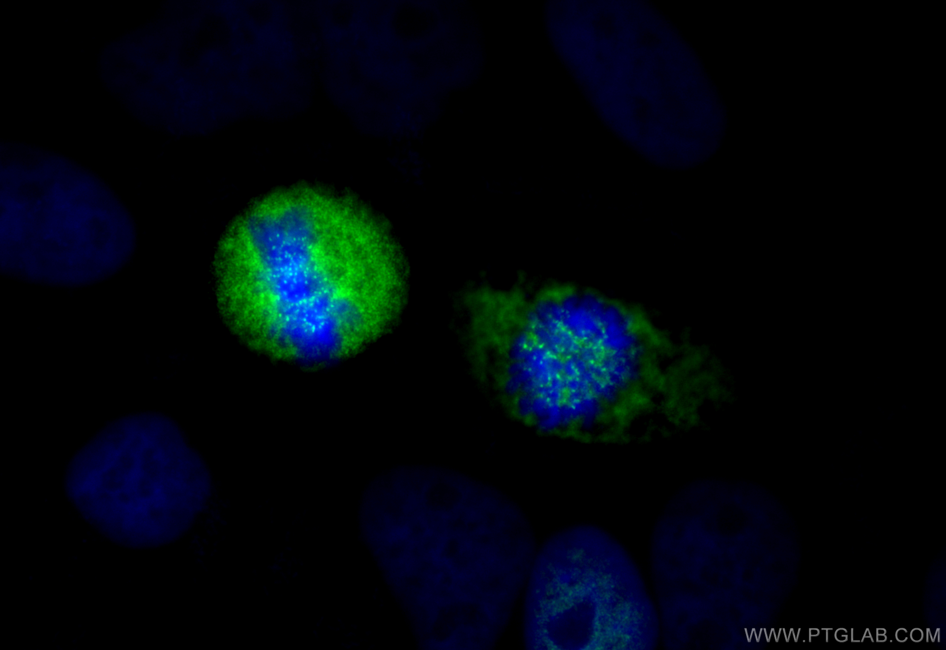 Immunofluorescence (IF) / fluorescent staining of HeLa cells using CENPF Polyclonal antibody (28568-1-AP)