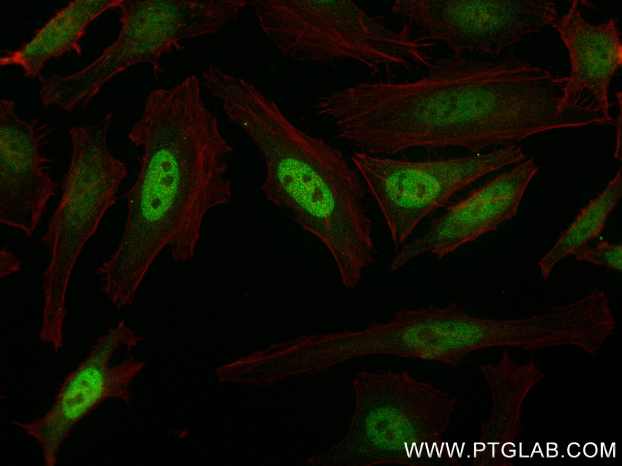 Immunofluorescence (IF) / fluorescent staining of HeLa cells using CENPF Recombinant antibody (84865-4-RR)