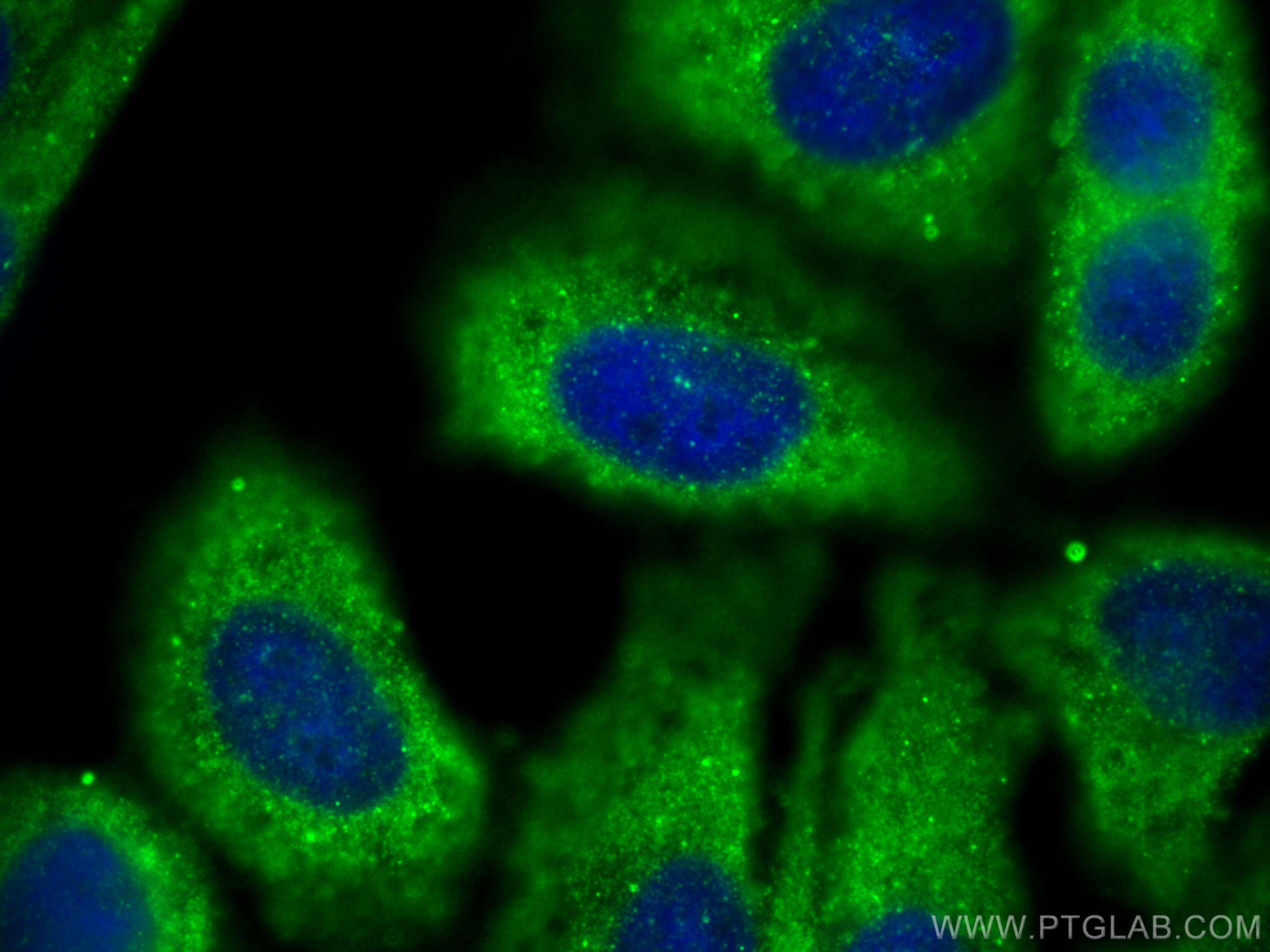 Immunofluorescence (IF) / fluorescent staining of HepG2 cells using CENPJ Polyclonal antibody (11517-1-AP)