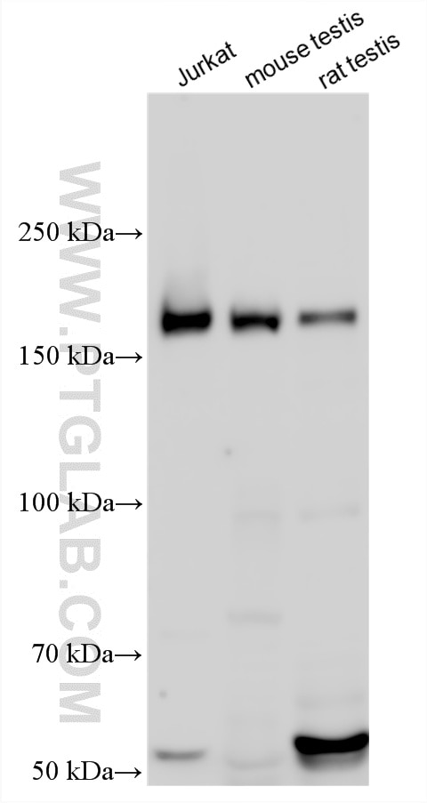 Western Blot (WB) analysis of various lysates using CENPJ Polyclonal antibody (11517-1-AP)