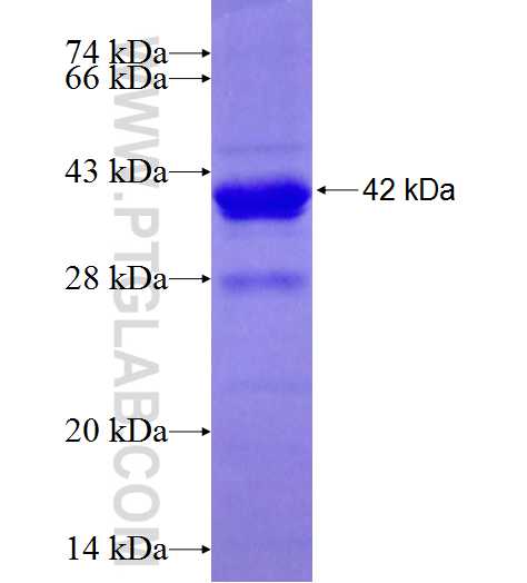 CENPJ fusion protein Ag28390 SDS-PAGE