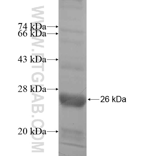 CENPM fusion protein Ag13946 SDS-PAGE