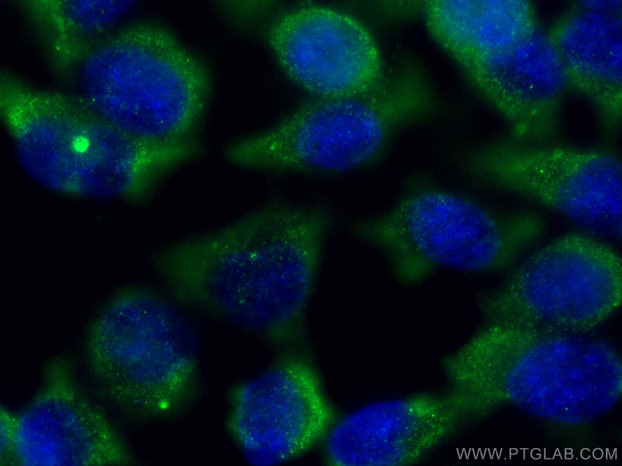 Immunofluorescence (IF) / fluorescent staining of HeLa cells using CEP135 Monoclonal antibody (68715-1-Ig)