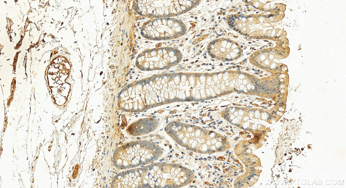 Immunohistochemistry (IHC) staining of human colon tissue using CEP164 Polyclonal antibody (22227-1-AP)