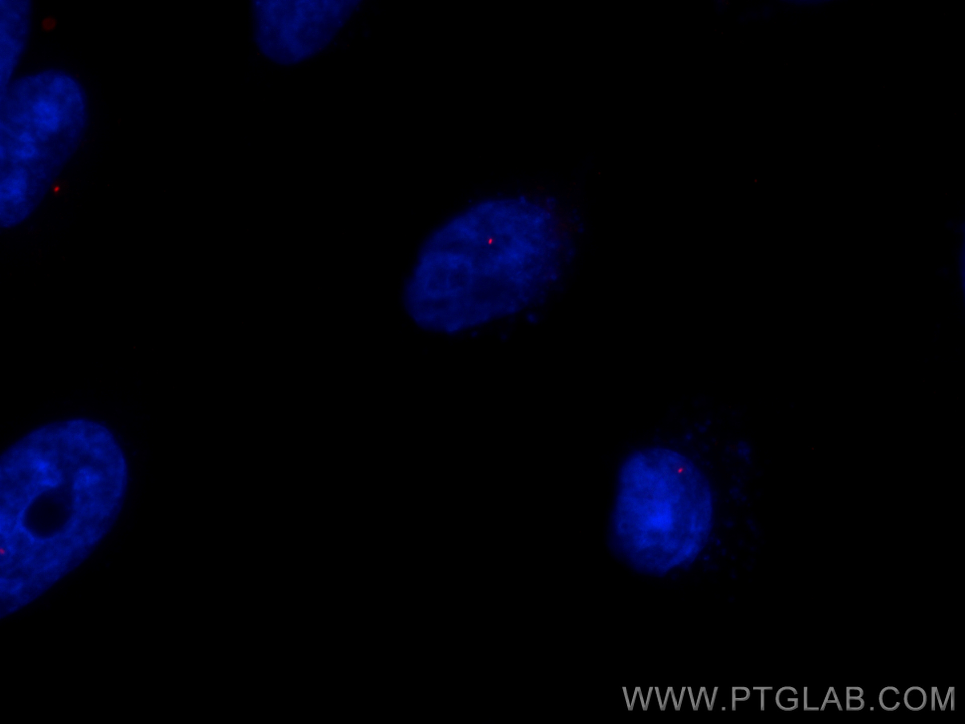 Immunofluorescence (IF) / fluorescent staining of HeLa cells using CoraLite®594-conjugated CEP164 Polyclonal antibody (CL594-22227)