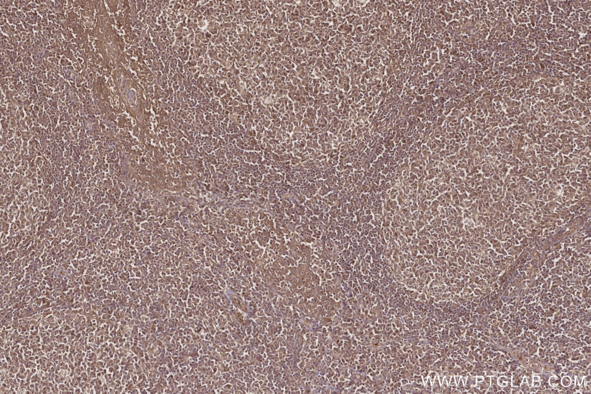 Immunohistochemistry (IHC) staining of human tonsillitis tissue using CEP192 Polyclonal antibody (28700-1-AP)