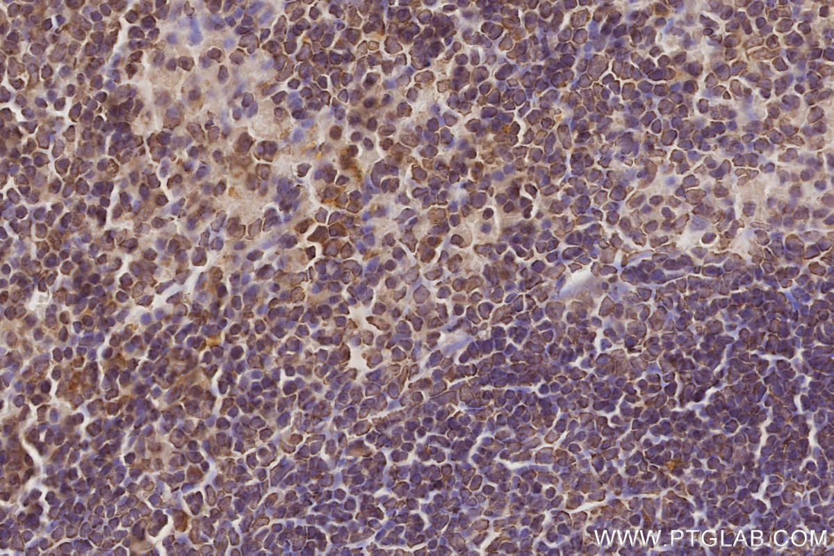 Immunohistochemistry (IHC) staining of mouse spleen tissue using CEP250/CNAP1 Monoclonal antibody (66814-1-Ig)