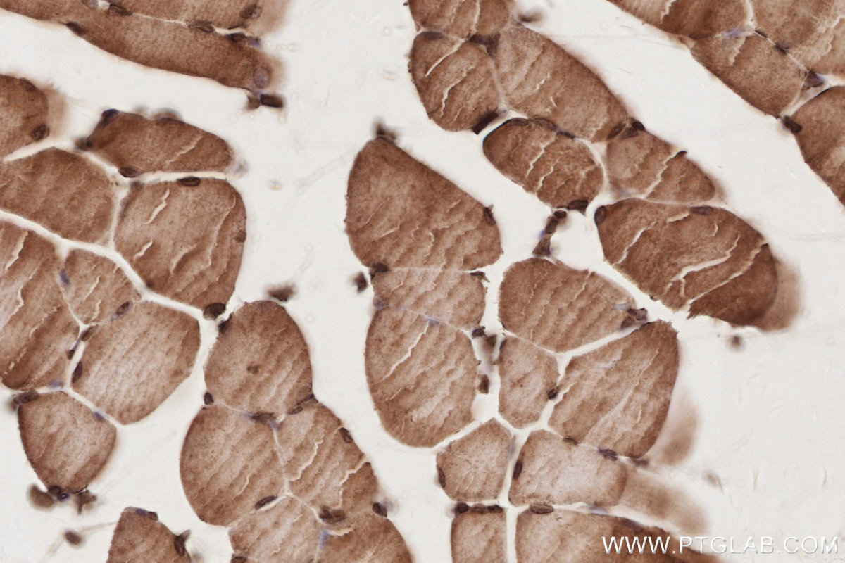 Immunohistochemistry (IHC) staining of mouse skeletal muscle tissue using CEP250/CNAP1 Monoclonal antibody (66814-1-Ig)