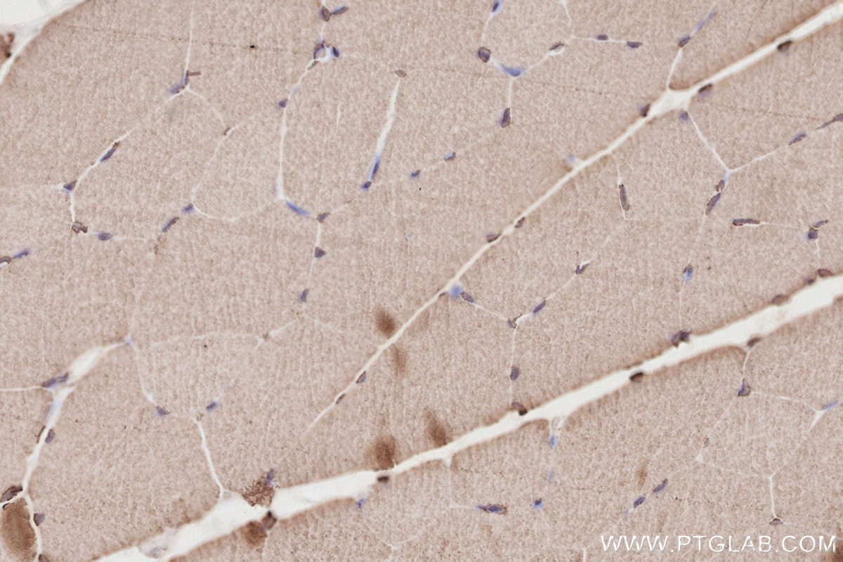 Immunohistochemistry (IHC) staining of rat skeletal muscle tissue using CEP250/CNAP1 Monoclonal antibody (66814-1-Ig)