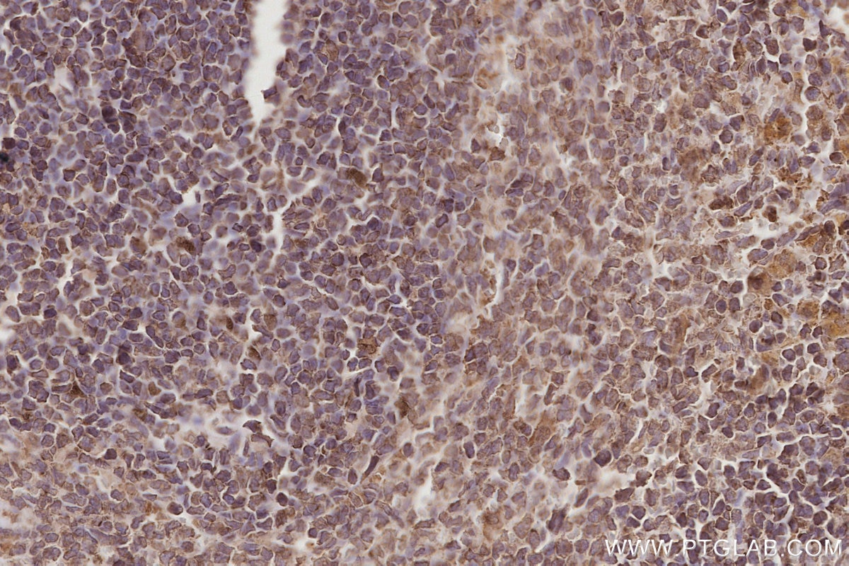 Immunohistochemistry (IHC) staining of rat spleen tissue using CEP250/CNAP1 Monoclonal antibody (66814-1-Ig)