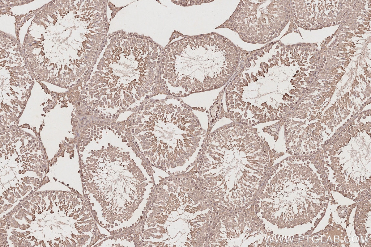 Immunohistochemistry (IHC) staining of rat testis tissue using CEP250/CNAP1 Monoclonal antibody (66814-1-Ig)