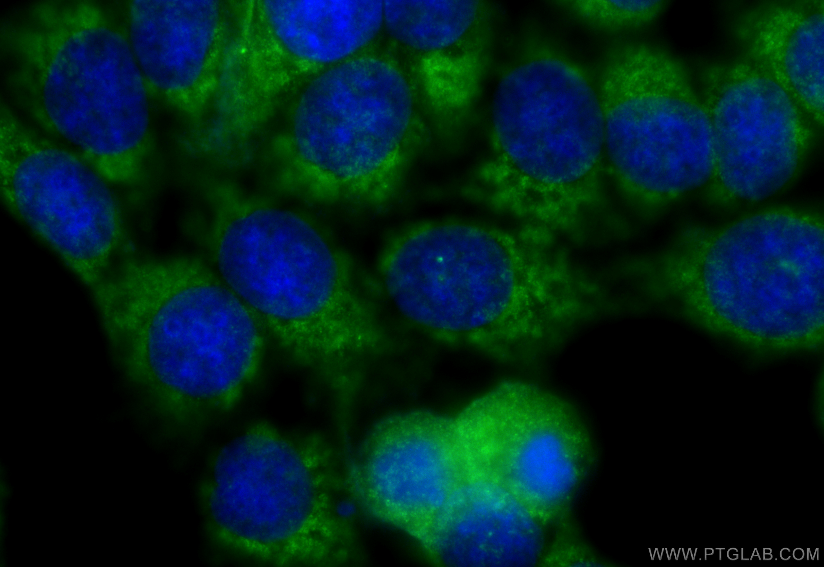 Immunofluorescence (IF) / fluorescent staining of MCF-7 cells using CEP290 Polyclonal antibody (22490-1-AP)