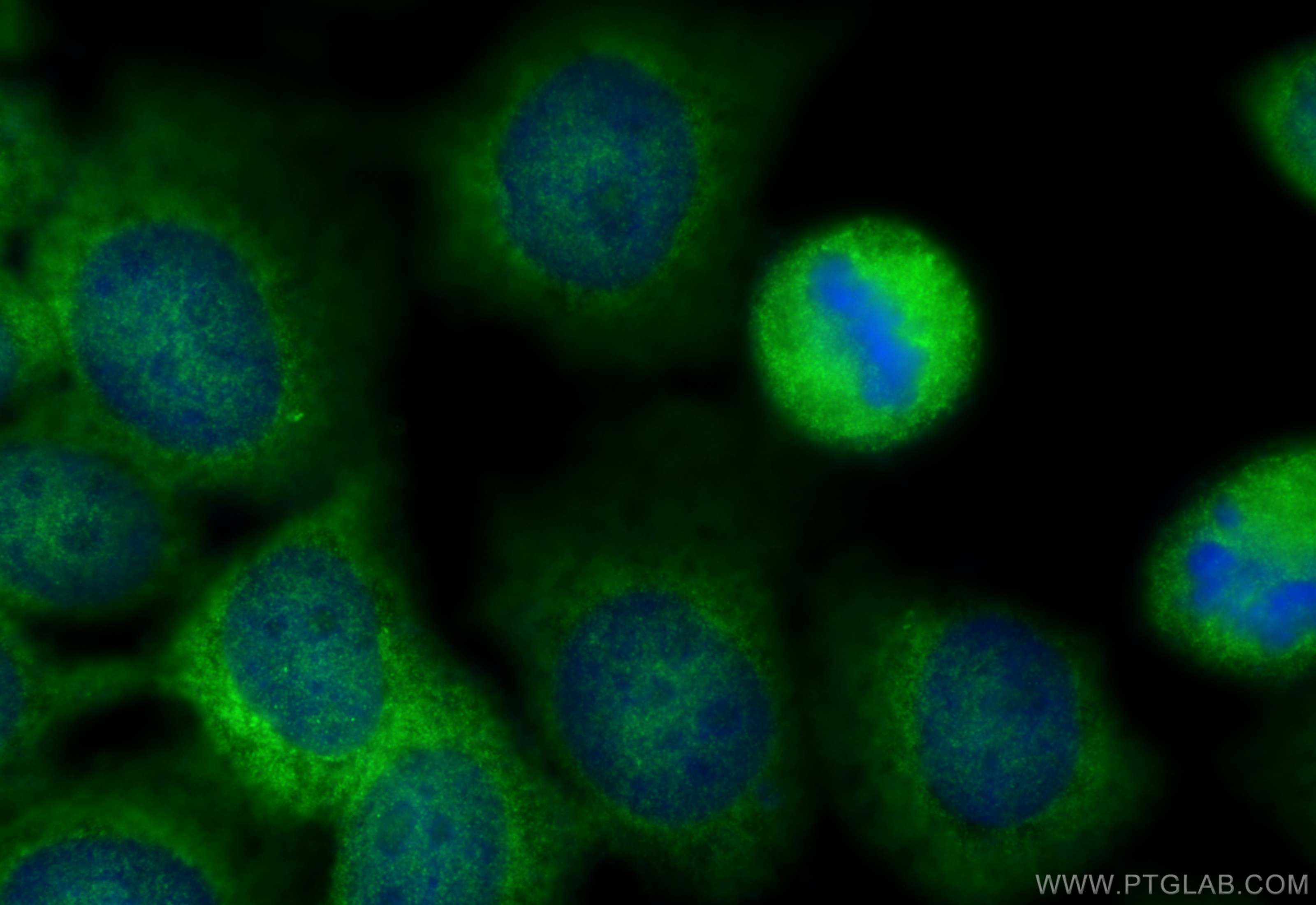 Immunofluorescence (IF) / fluorescent staining of A431 cells using CEP350-Specific Polyclonal antibody (20022-1-AP)