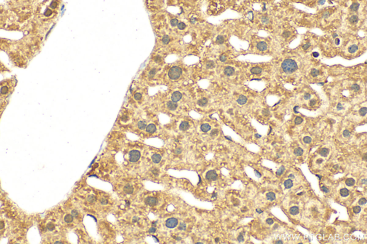 Immunohistochemistry (IHC) staining of mouse liver tissue using CEP350-Specific Polyclonal antibody (20022-1-AP)