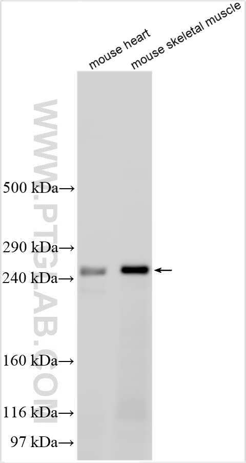 Western Blot (WB) analysis of various lysates using CEP350-Specific Polyclonal antibody (20022-1-AP)