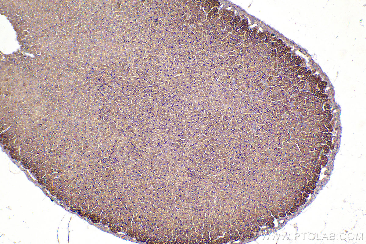 Immunohistochemistry (IHC) staining of mouse adrenal gland tissue using CEP55 Monoclonal antibody (67460-1-Ig)