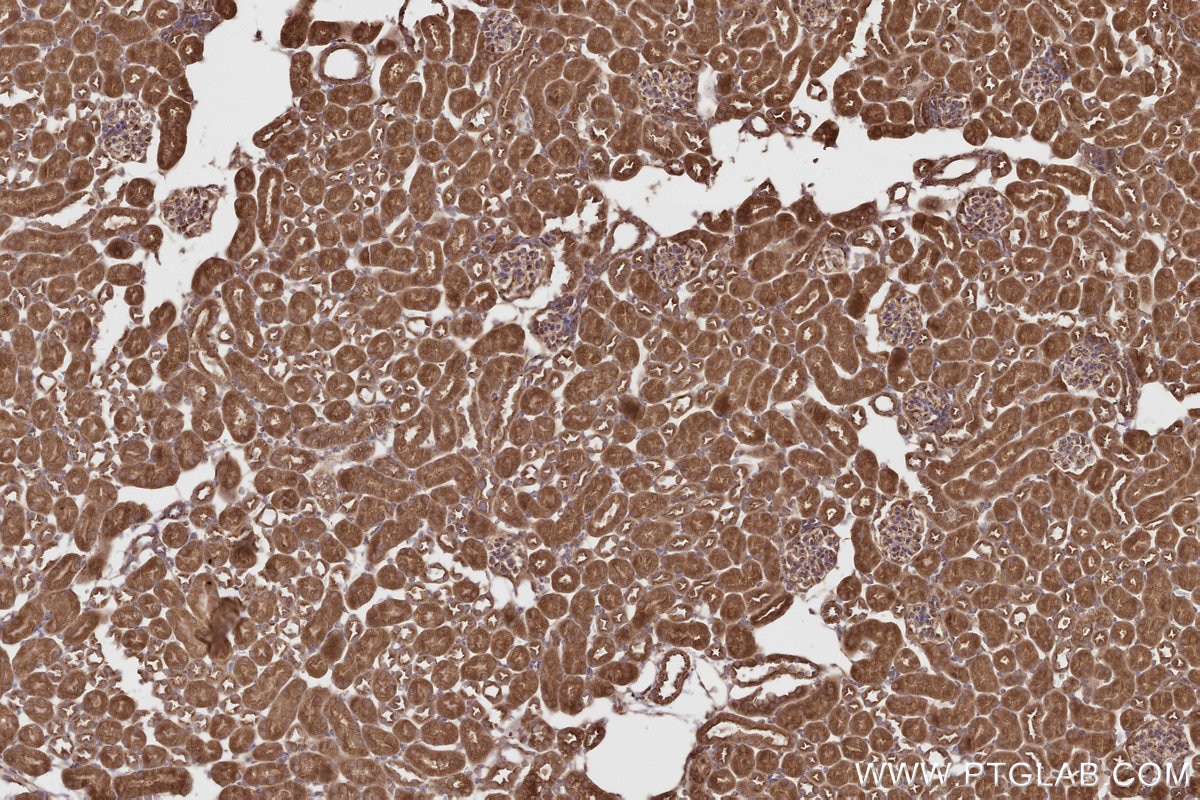 Immunohistochemistry (IHC) staining of mouse kidney tissue using CEP63 Polyclonal antibody (16268-1-AP)