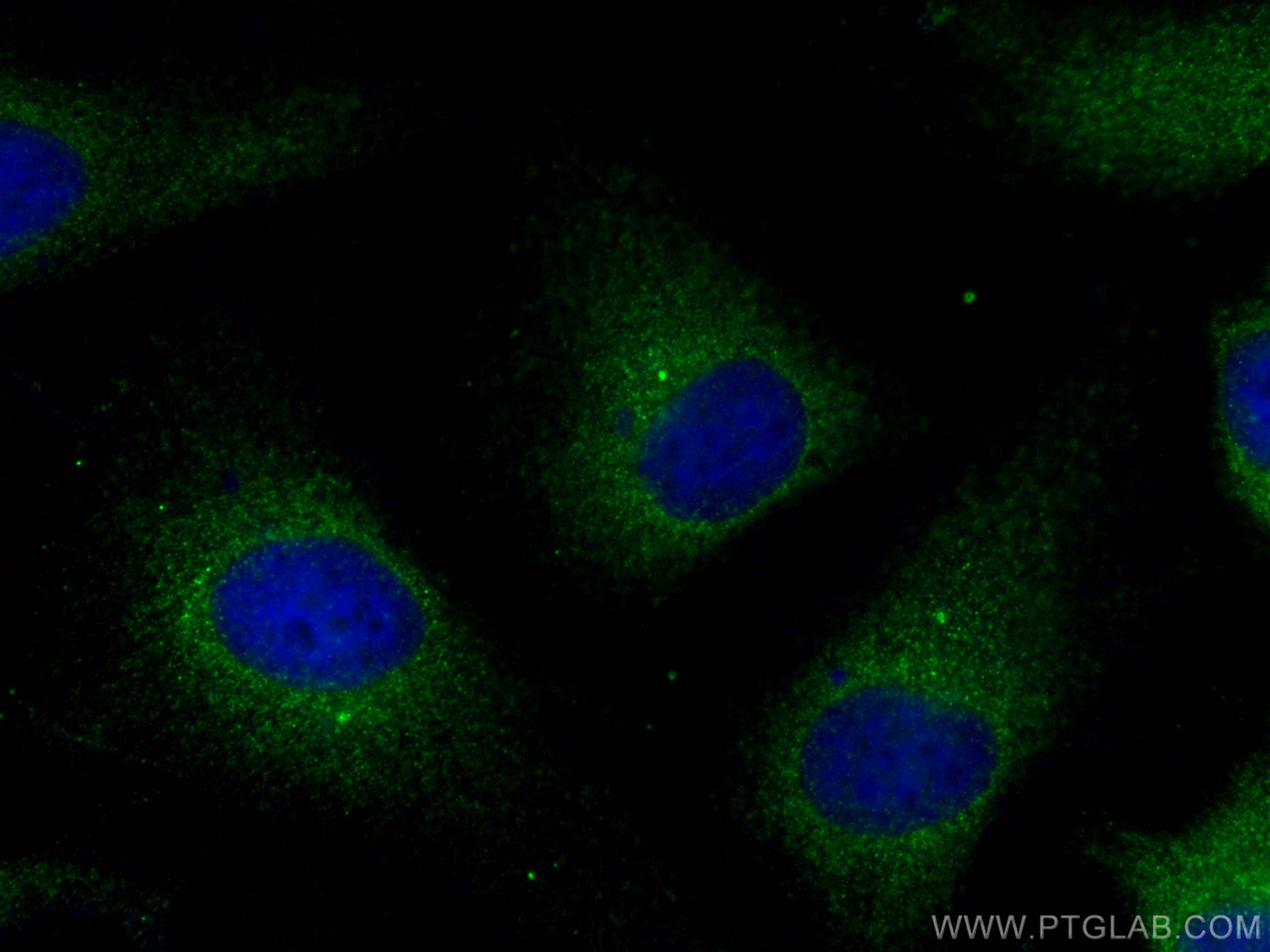 Immunofluorescence (IF) / fluorescent staining of HeLa cells using CEP70 Polyclonal antibody (16280-1-AP)