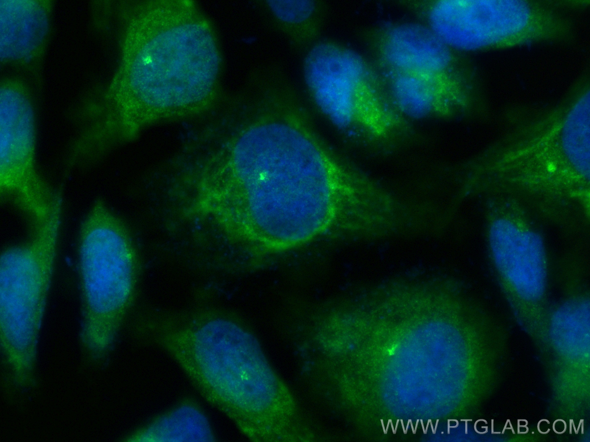 Immunofluorescence (IF) / fluorescent staining of HeLa cells using CEP72 Polyclonal antibody (19928-1-AP)