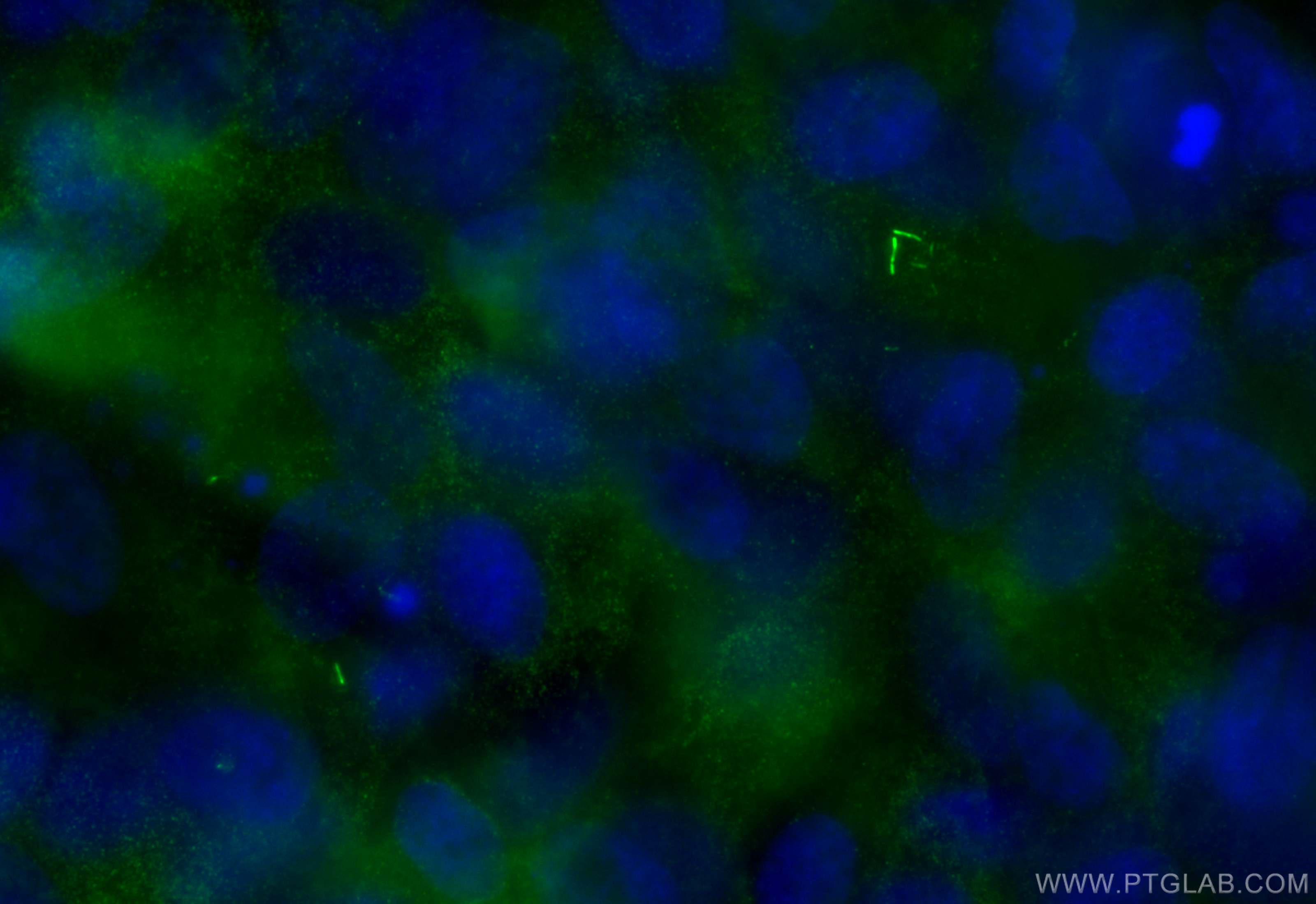 Immunofluorescence (IF) / fluorescent staining of hTERT-RPE1 cells using CEP89, CCDC123 Polyclonal antibody (30165-1-AP)