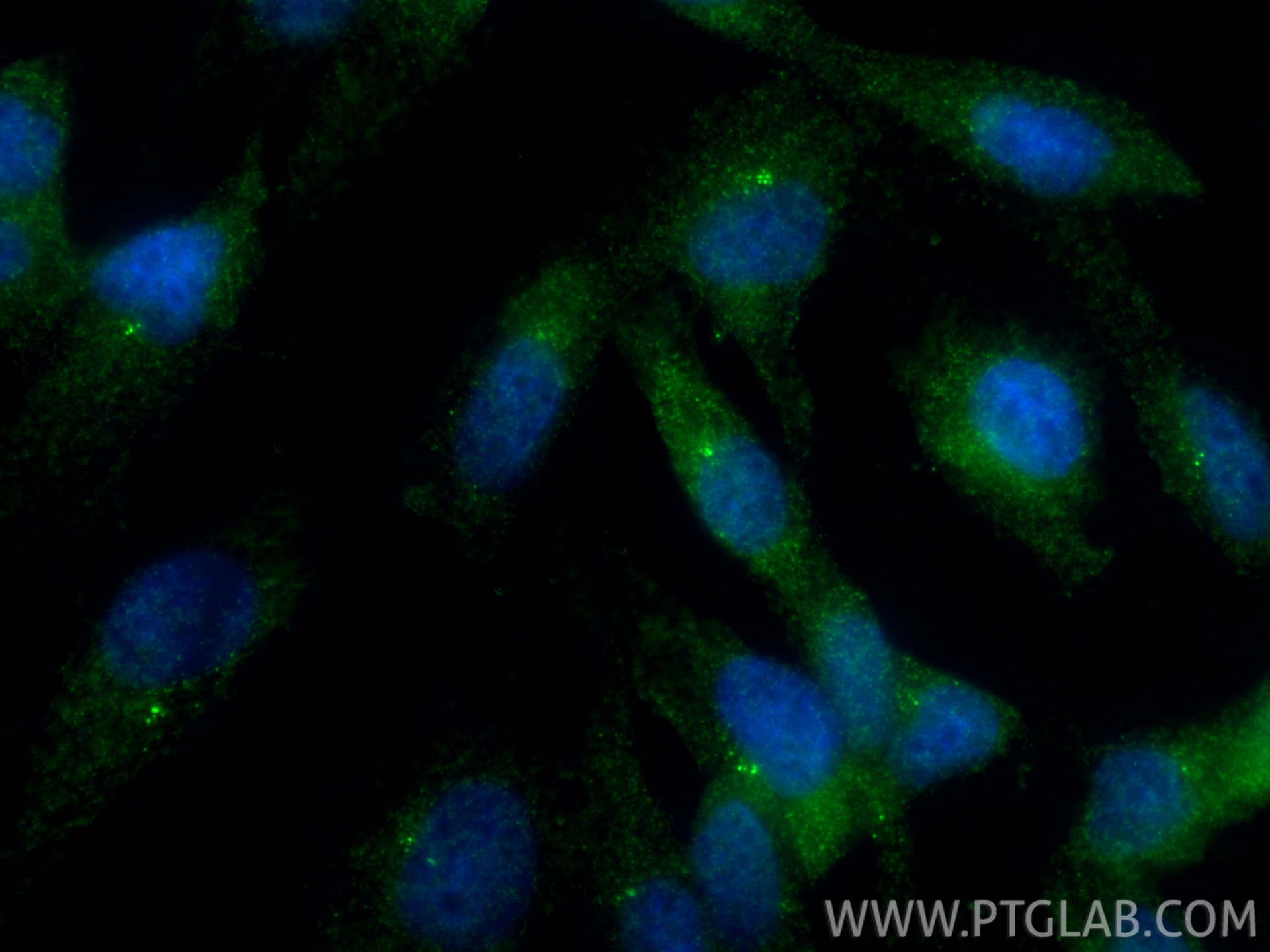 Immunofluorescence (IF) / fluorescent staining of MDCK cells using CEP97 Polyclonal antibody (22050-1-AP)