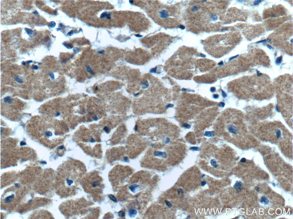 Immunohistochemistry (IHC) staining of human heart tissue using CERK Polyclonal antibody (10467-1-AP)