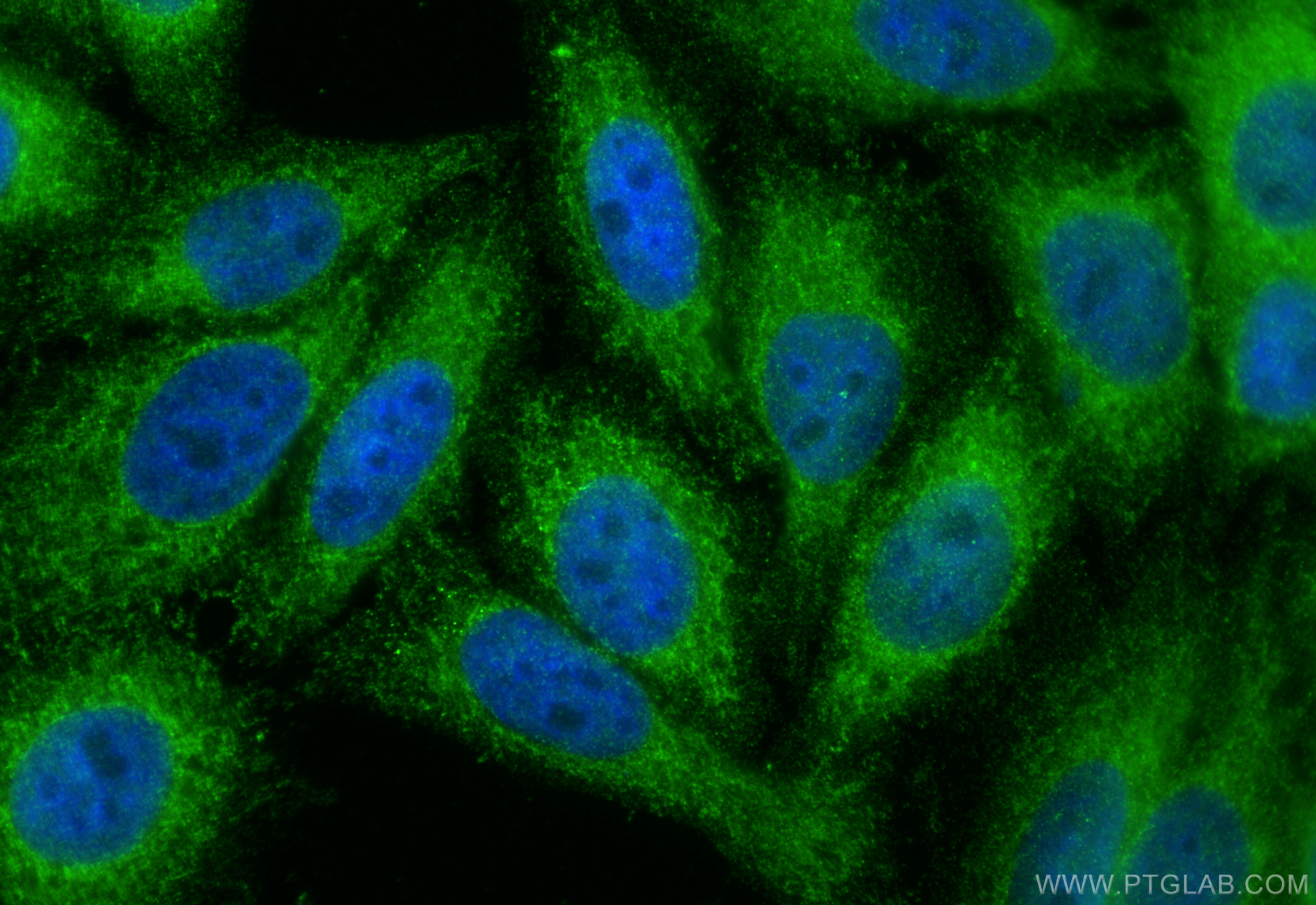 Immunofluorescence (IF) / fluorescent staining of HepG2 cells using CES1 Polyclonal antibody (16912-1-AP)