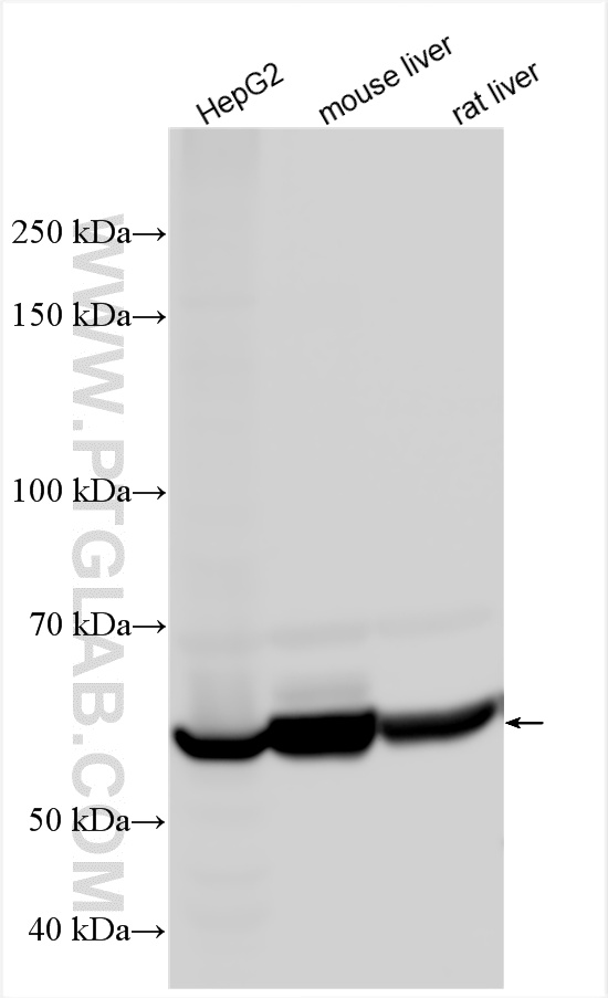 Western Blot (WB) analysis of various lysates using CES1 Polyclonal antibody (16912-1-AP)