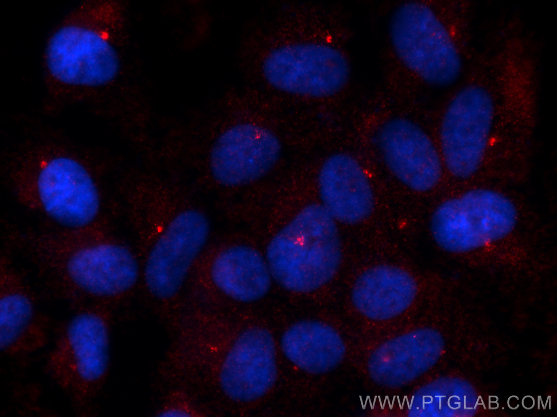 Immunofluorescence (IF) / fluorescent staining of hTERT-RPE1 cells using Centrin 1 Polyclonal antibody (12794-1-AP)