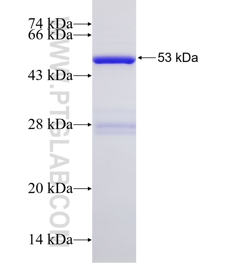 CETP fusion protein Ag32722 SDS-PAGE