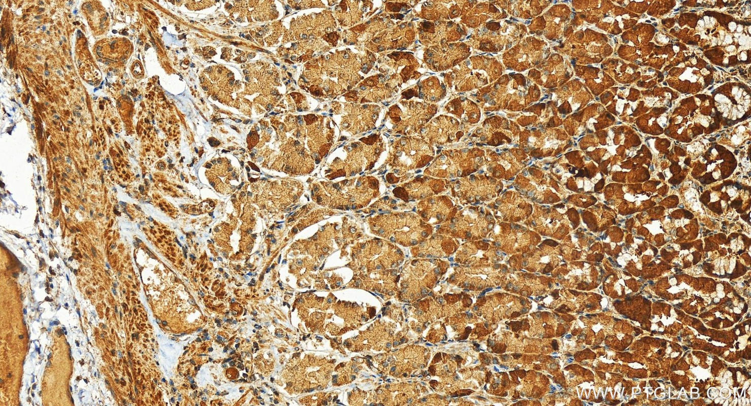 Immunohistochemistry (IHC) staining of human stomach tissue using Factor D/CFD Polyclonal antibody (26050-1-AP)