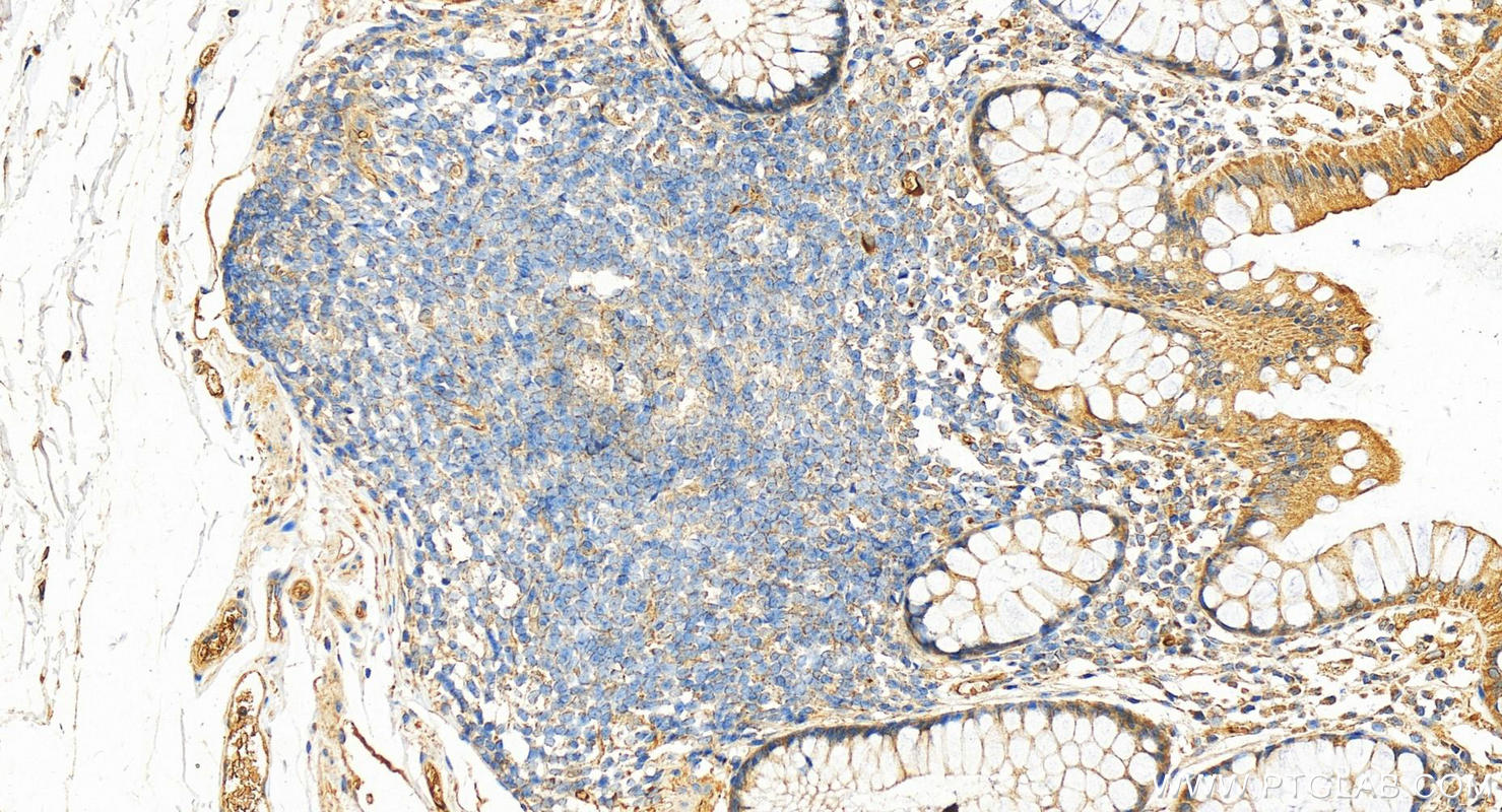 Immunohistochemistry (IHC) staining of human normal colon using Complement factor H Polyclonal antibody (12748-1-AP)