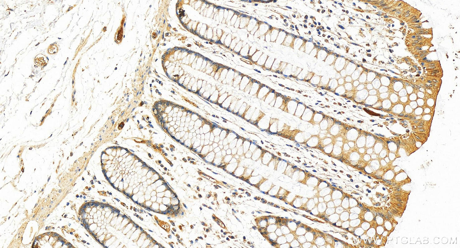 Immunohistochemistry (IHC) staining of human normal colon using Complement factor H Polyclonal antibody (12748-1-AP)