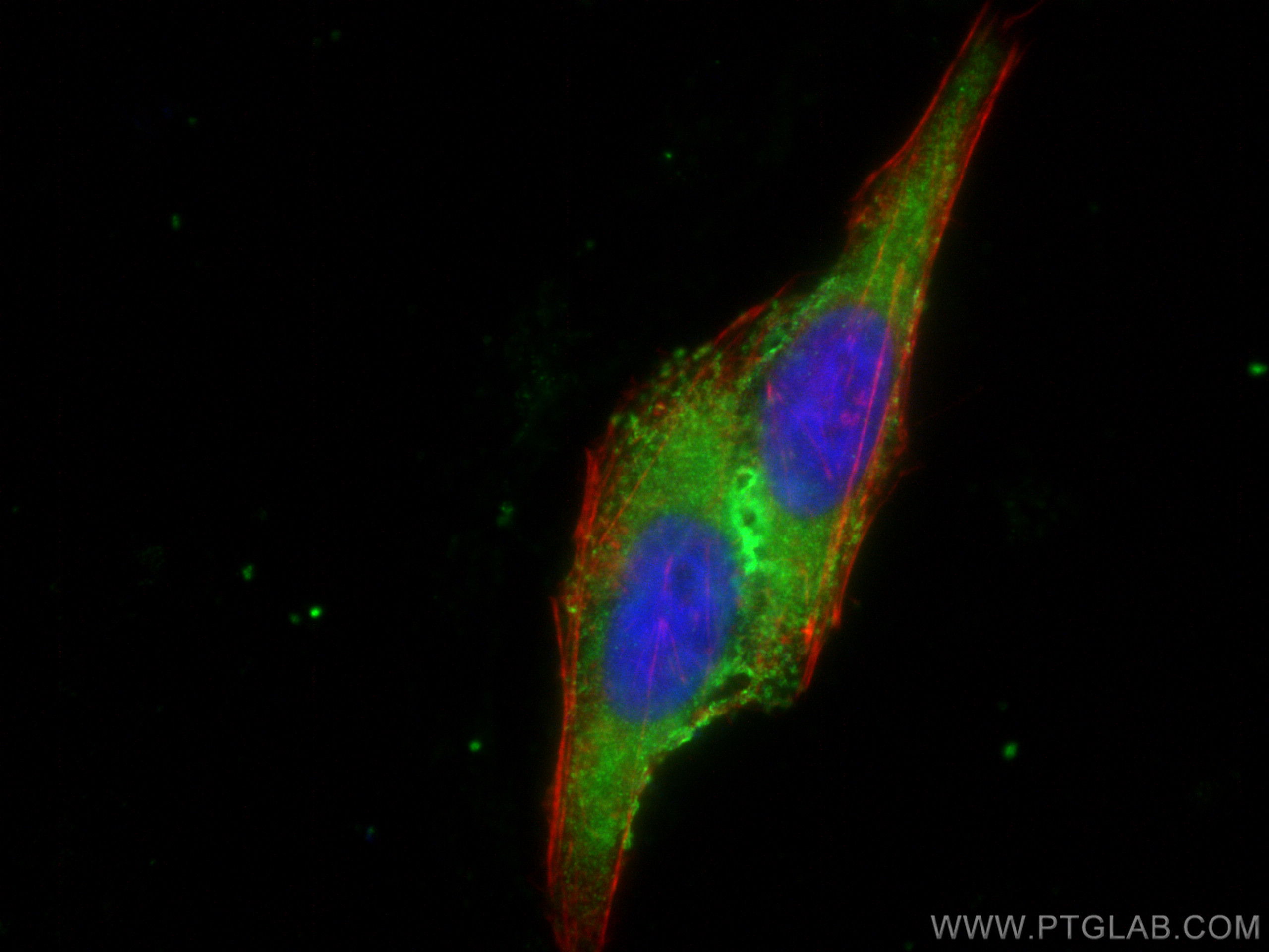 Immunofluorescence (IF) / fluorescent staining of HepG2 cells using Complement factor H Polyclonal antibody (12748-1-AP)
