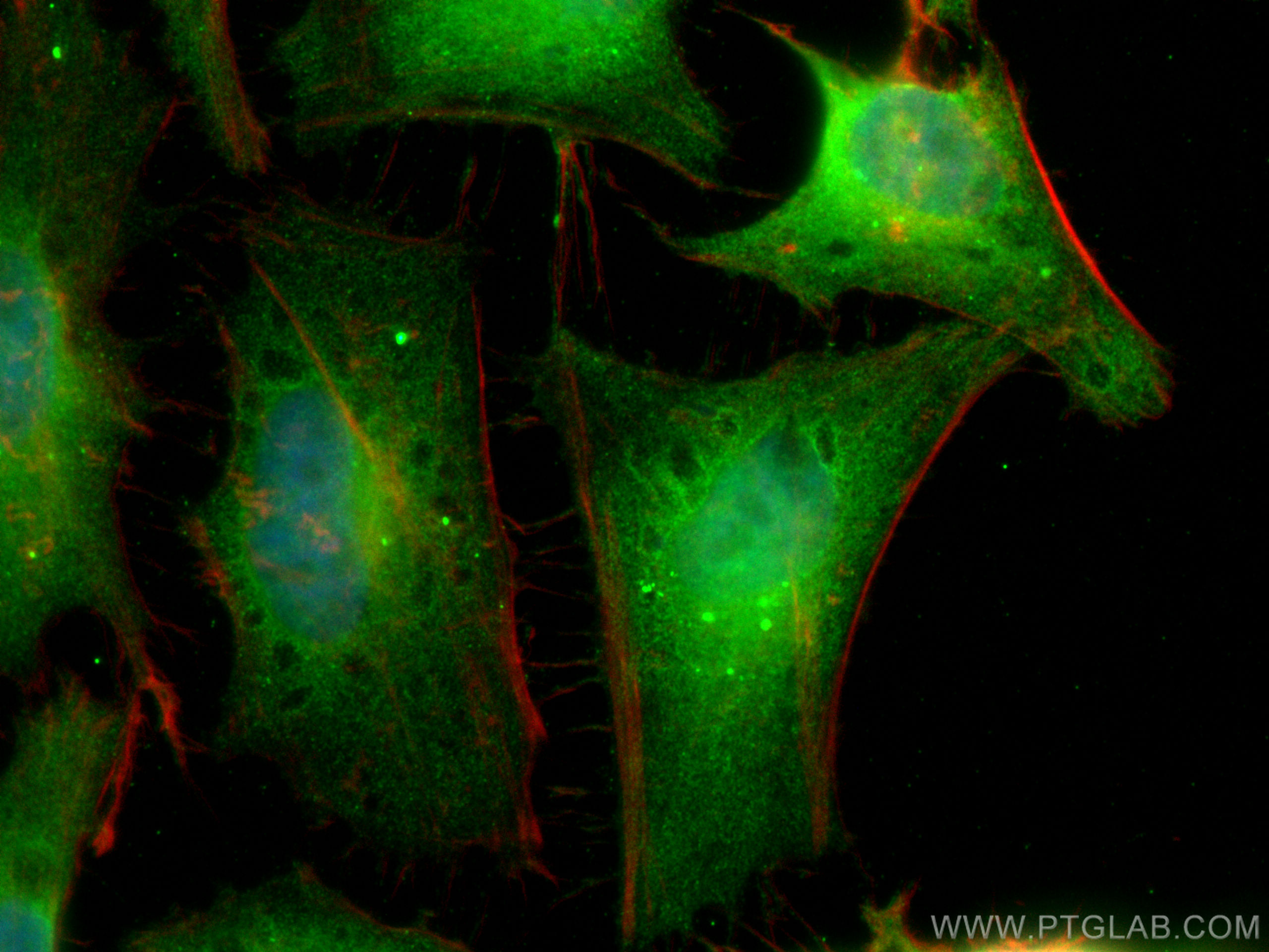 Immunofluorescence (IF) / fluorescent staining of HeLa cells using Cofilin Monoclonal antibody (66057-1-Ig)