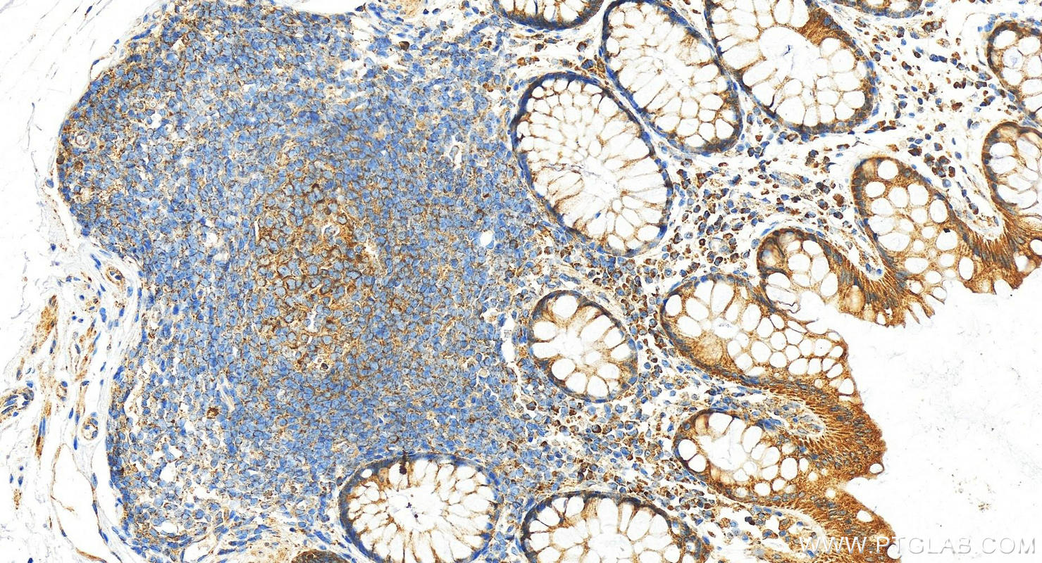 Immunohistochemistry (IHC) staining of human normal colon using Cofilin 2 Polyclonal antibody (11848-1-AP)