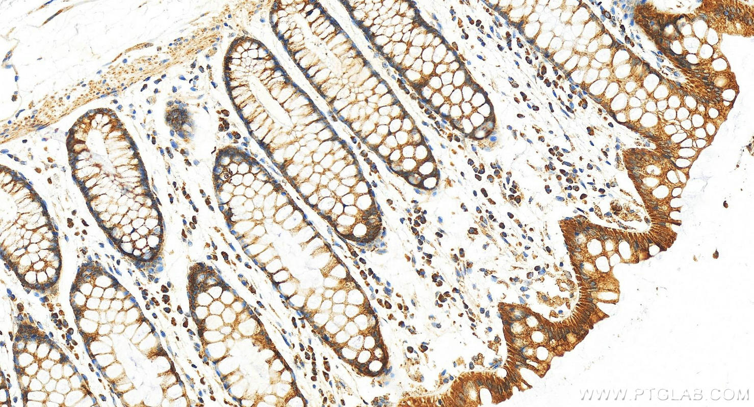 Immunohistochemistry (IHC) staining of human normal colon using Cofilin 2 Polyclonal antibody (11848-1-AP)