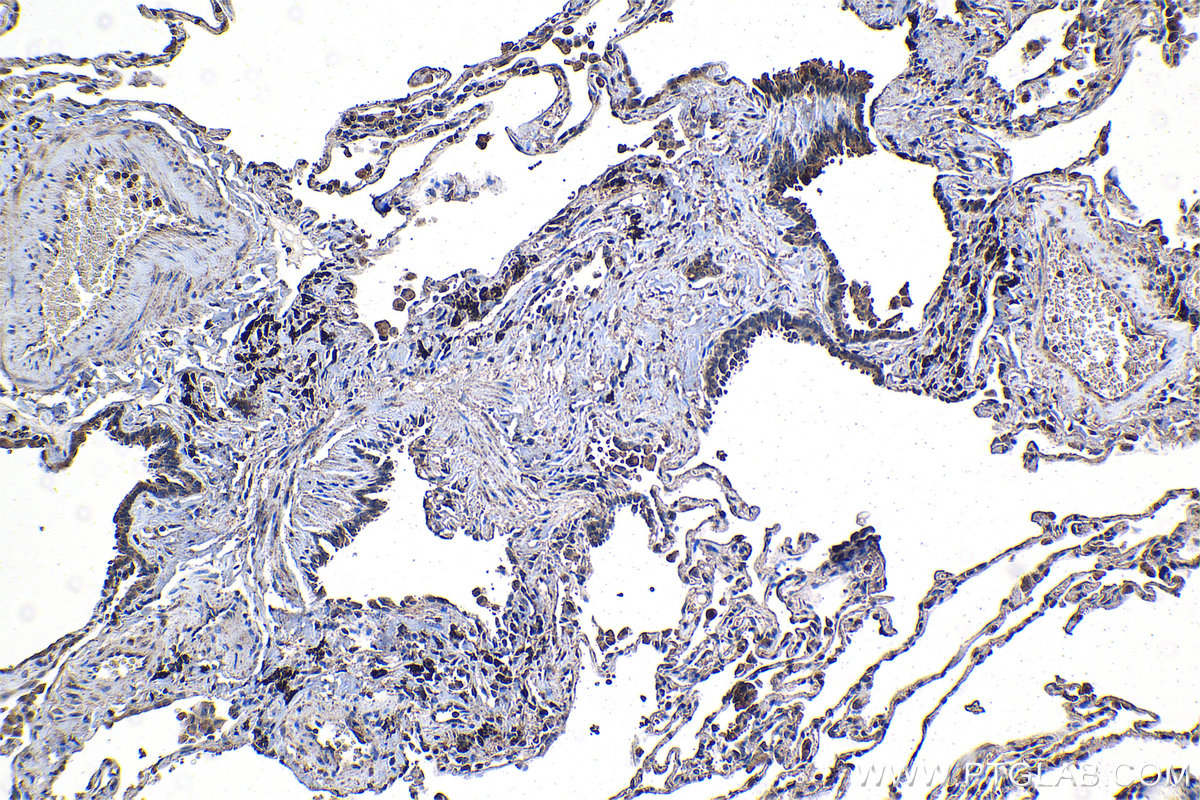 Immunohistochemistry (IHC) staining of human lung tissue using CFTR Monoclonal antibody (66928-1-Ig)